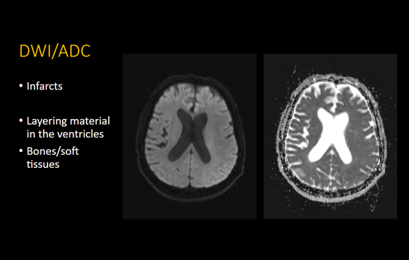 Routine Brain MRI Search Pattern