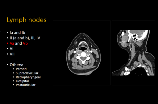 Neck CT Search Pattern