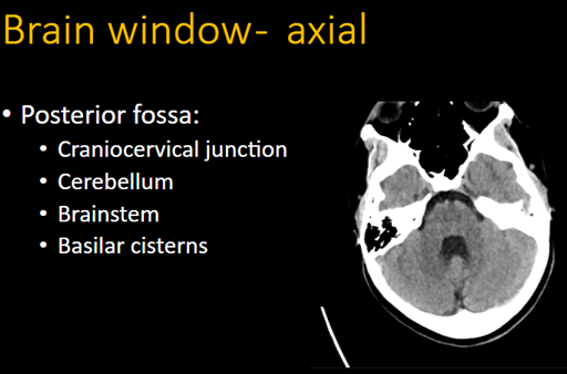 Head CT Search Pattern