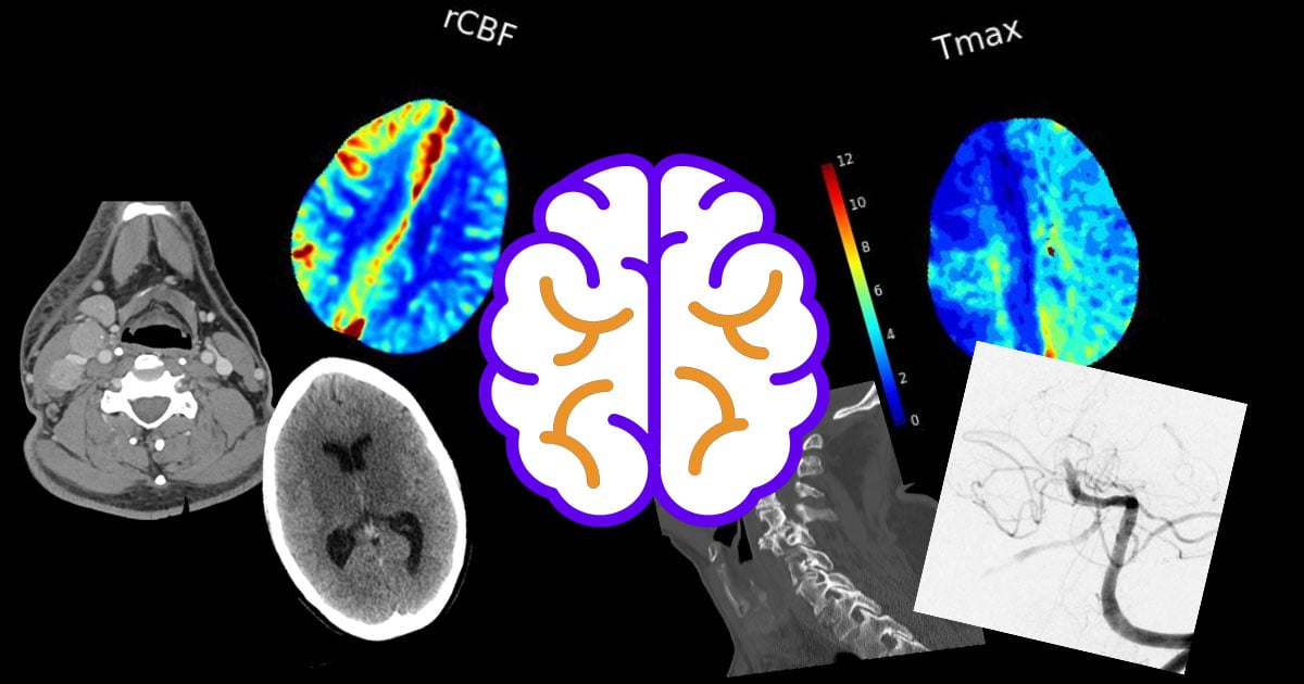 Sample Cases from EDNeuroRad.com